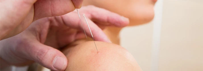 Sports Medicine Lakewood CO Dry Needling